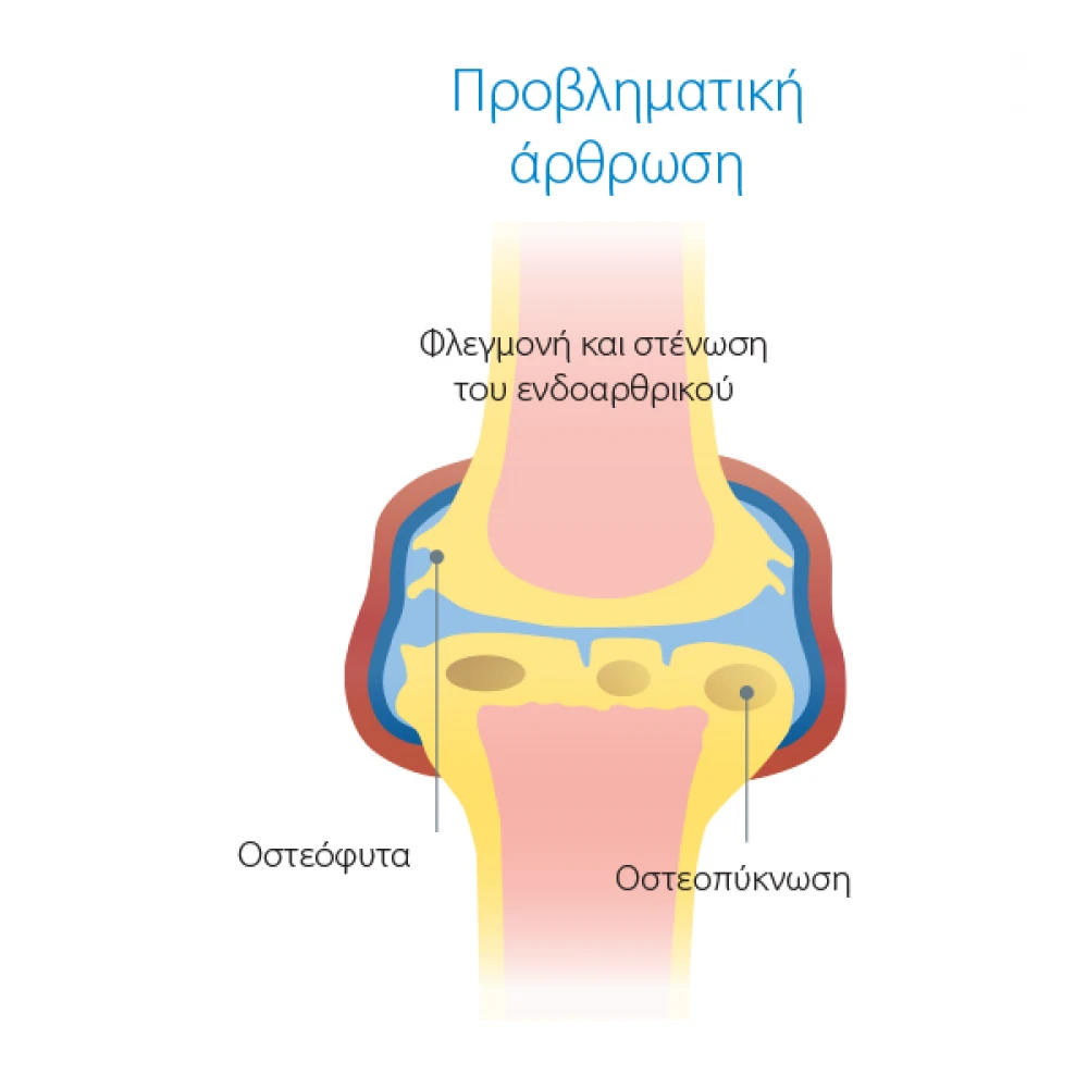 Συμπλήρωμα Διατροφής Χονδροπροστατευτικό Για Σκύλους Και Γάτες Wejoint Plus Small Breed 30 Δισκία 5 Συμπλήρωμα Διατροφής Χονδροπροστατευτικό Για Σκύλους Και Γάτες Wejoint Plus Small Breed 30 Δισκία - Image 5